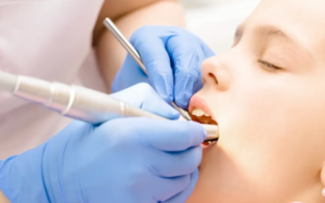 4 Benefits Of Restorative Fillings For Long Term Oral Health